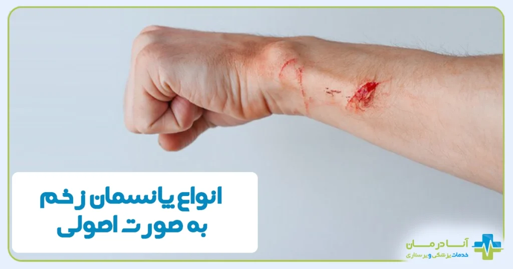 انواع زخم و آموزش تعویض | پانسمان زخم به صورت اصولی | معرفی انواع زخم